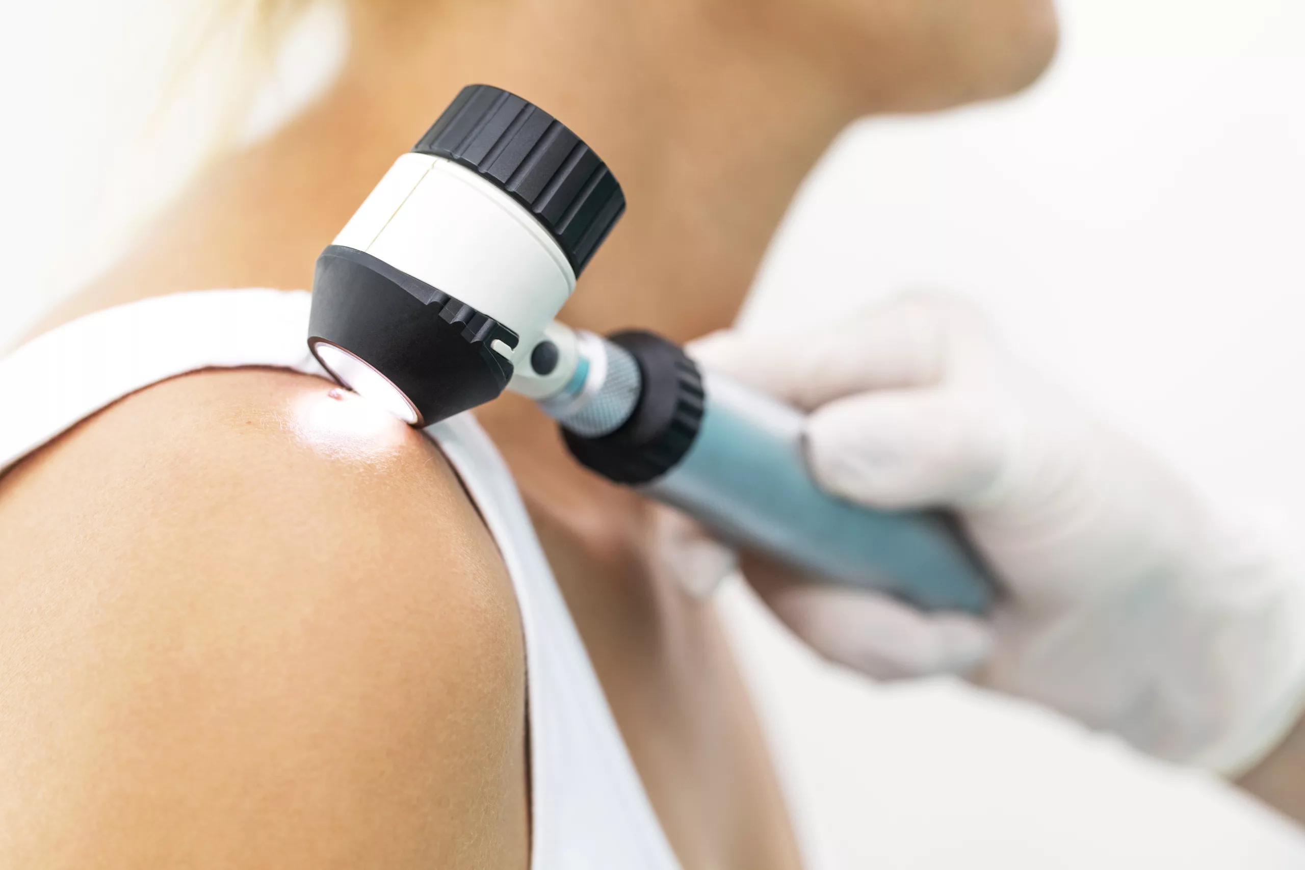 clinica-belmedic-medicina-estetica-porto-dermatologia
