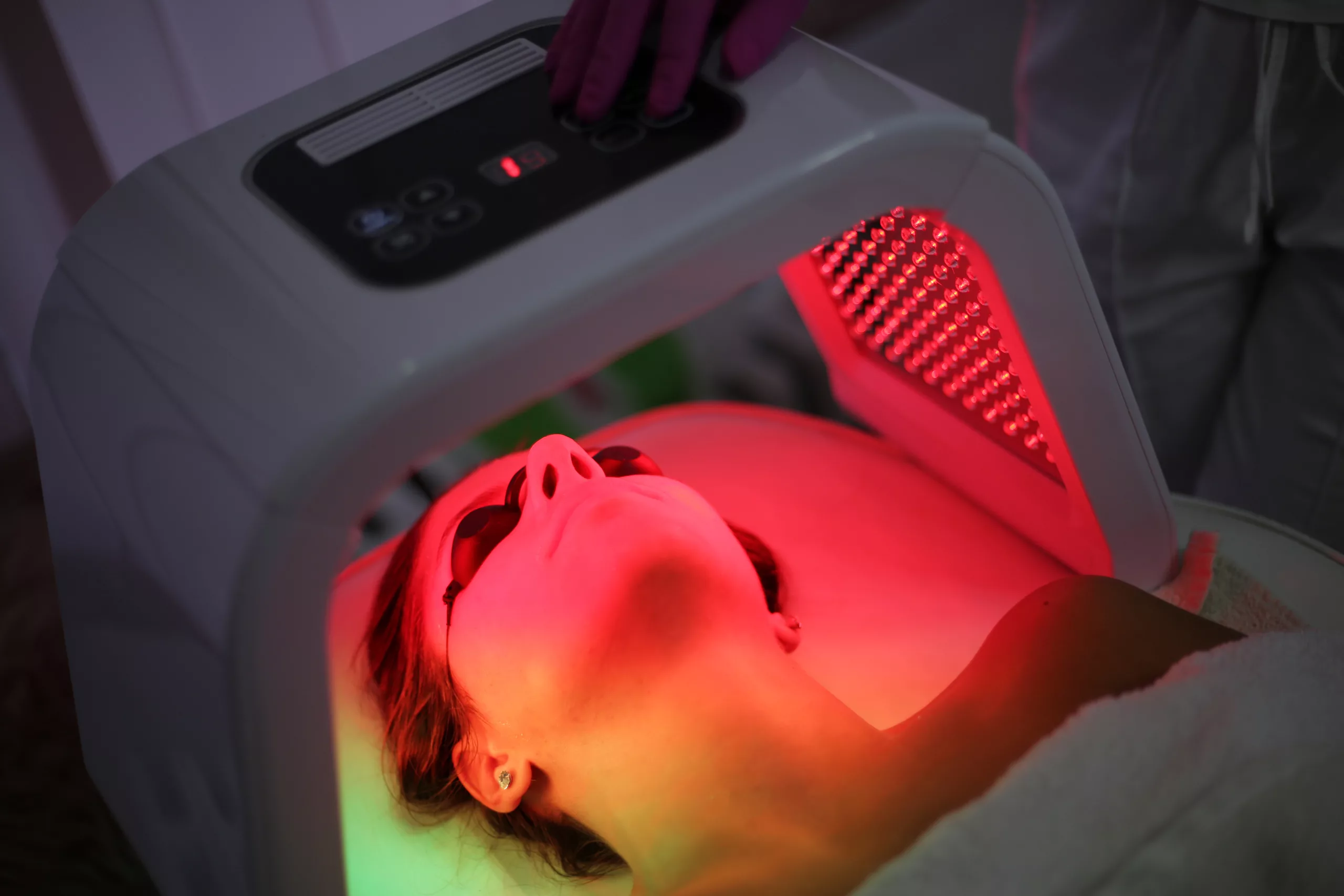 clinica-belmedic-medicina-estetica-porto-ledterapia