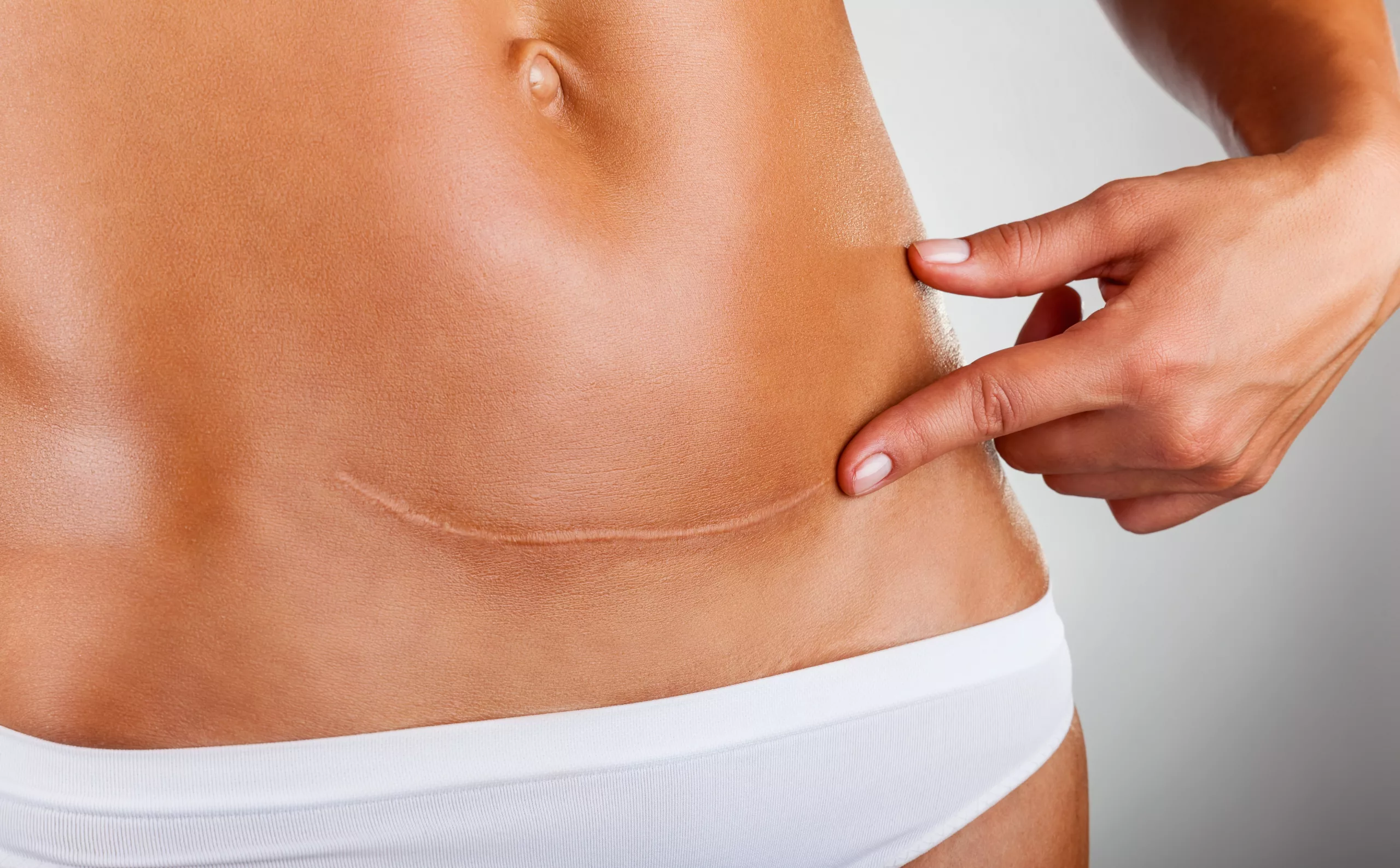 clinica-belmedic-medicina-estetica-porto-cicatrizes