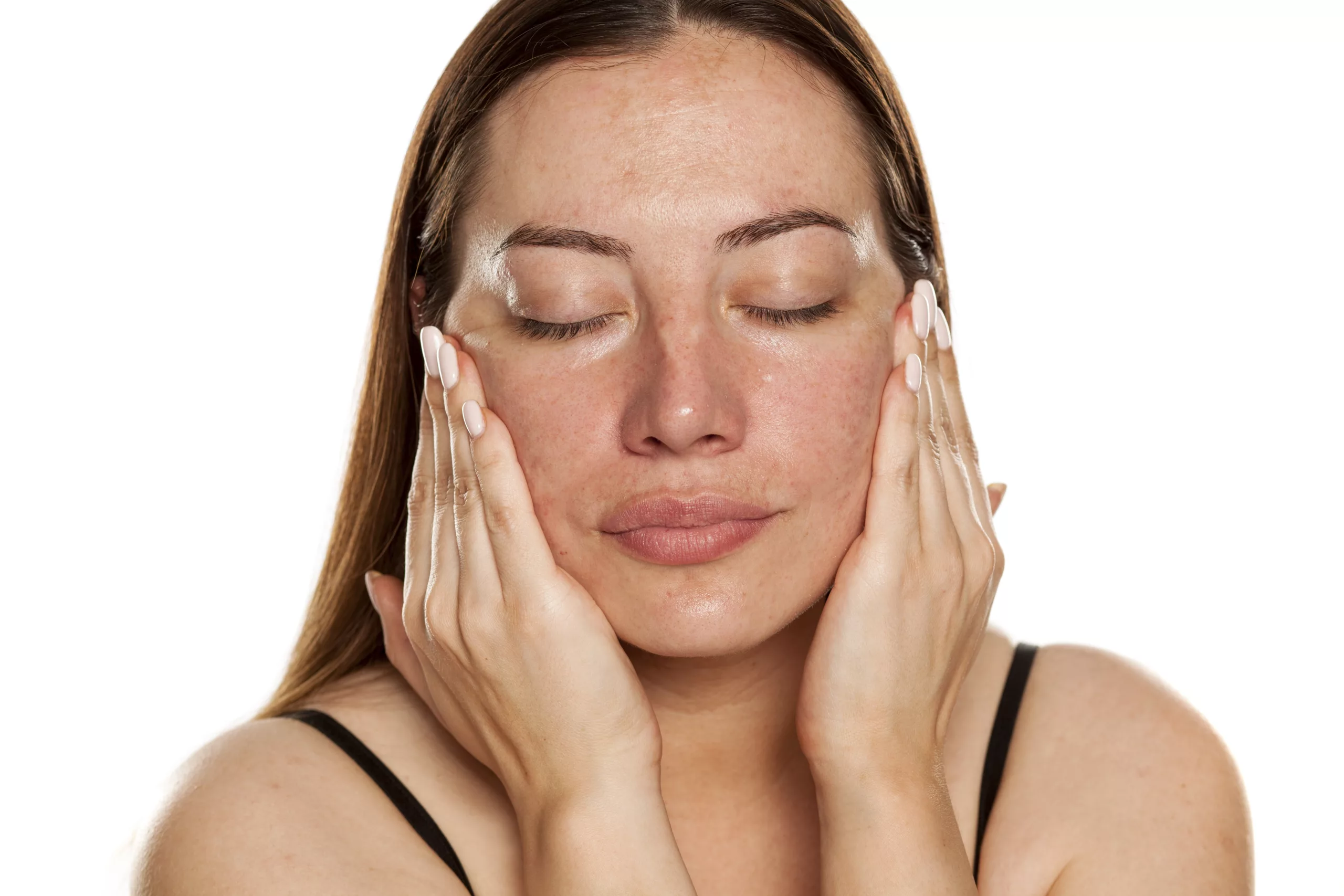clinica-belmedic-medicina-estetica-porto-manchas