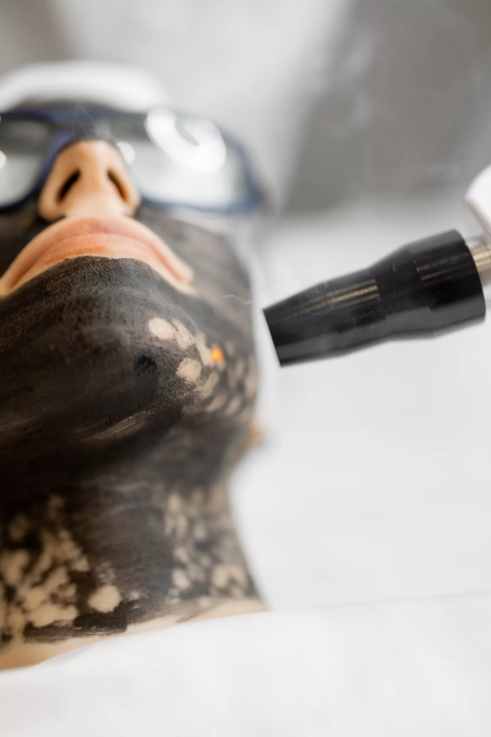 clinica-belmedic-medicina-estetica-porto-tratamento-laser-co2