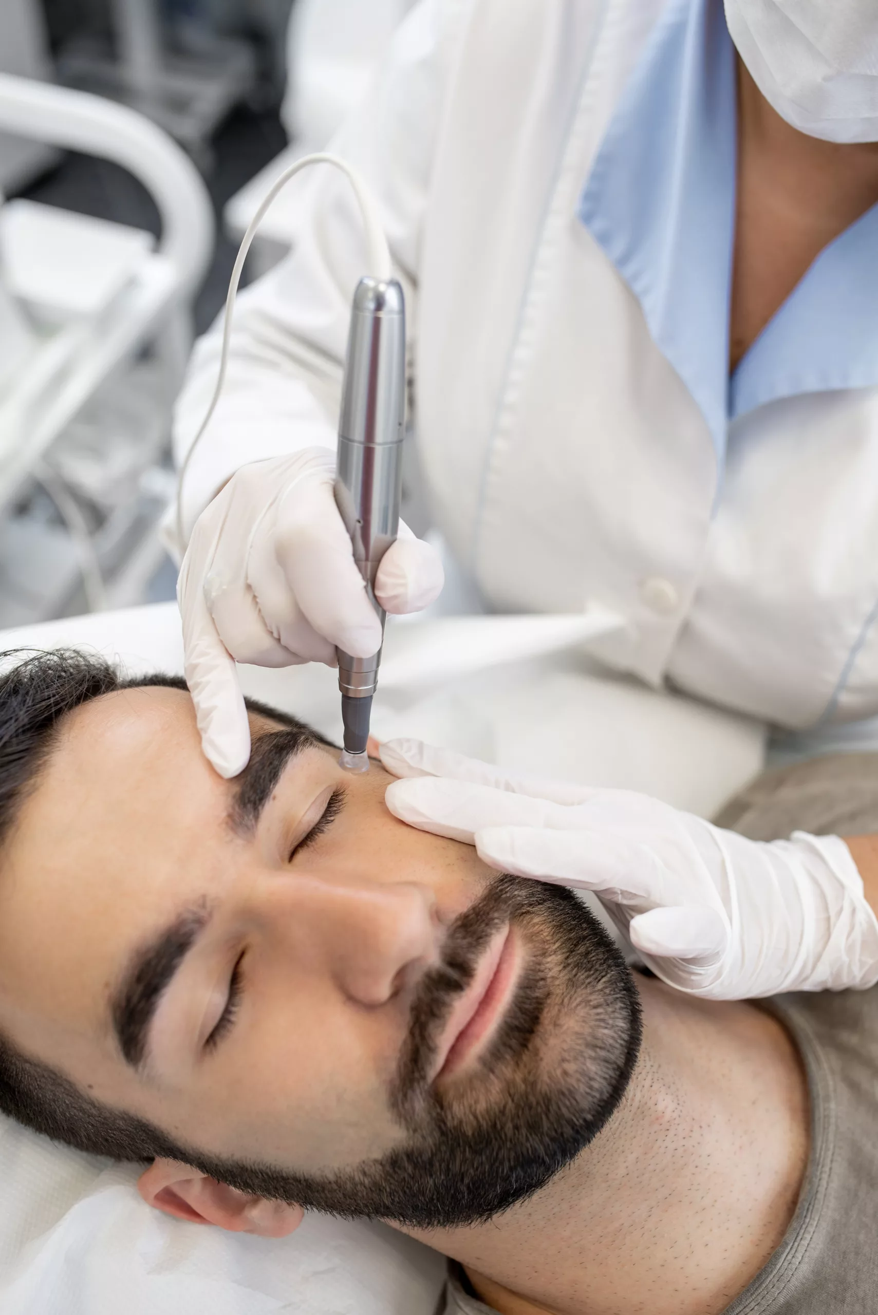 clinica-belmedic-medicina-estetica-porto-tratamento-microagulhamento