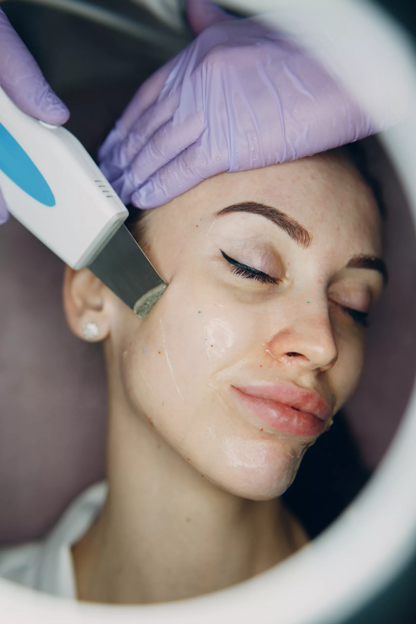 clinica-belmedic-medicina-estetica-porto-tratamento-peeling-ultrassonico